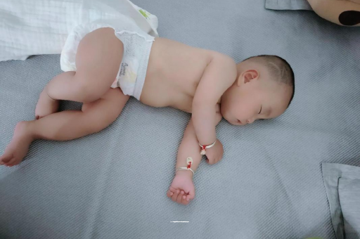 揭阳六个月宝宝眼睛散光